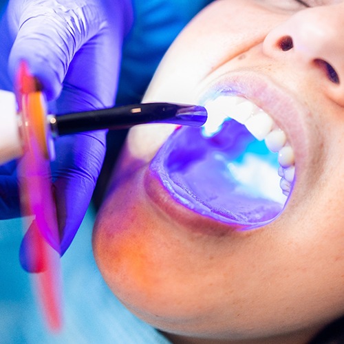 A woman getting cosmetic bonding at the dentist