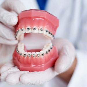 a dentist holding a model of teeth with braces